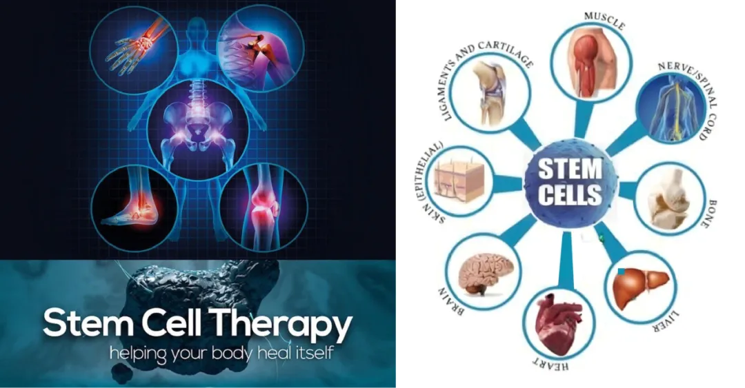 Stem Cell Therapy Healing Benefits